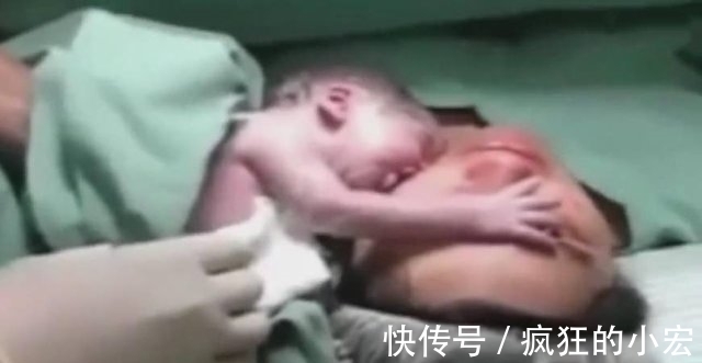 医师|妈妈刚刚生下孩子就停止心跳,宝宝伸手摸着母亲脸庞,奇迹出现了