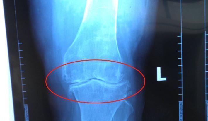 睡眠时间|男生身高多少岁“停止发育”?不是18,也不是23,而是这个数