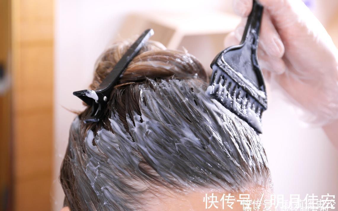 过敏|经常染发“危害”是什么?少数人过敏,还比较伤头发,但可以变美