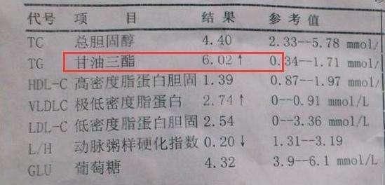 运动锻炼|不吃药,甘油三酯也能降下来!70岁老人的3条降脂经验,值得借鉴