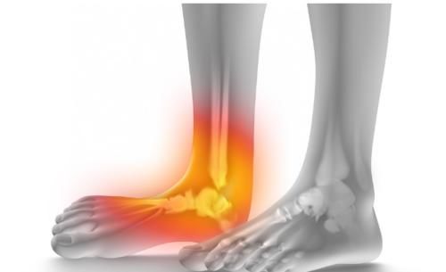 低蛋白质|尿毒症开始时，这3个部位会“疼痛”，敦促患者尽快就医！