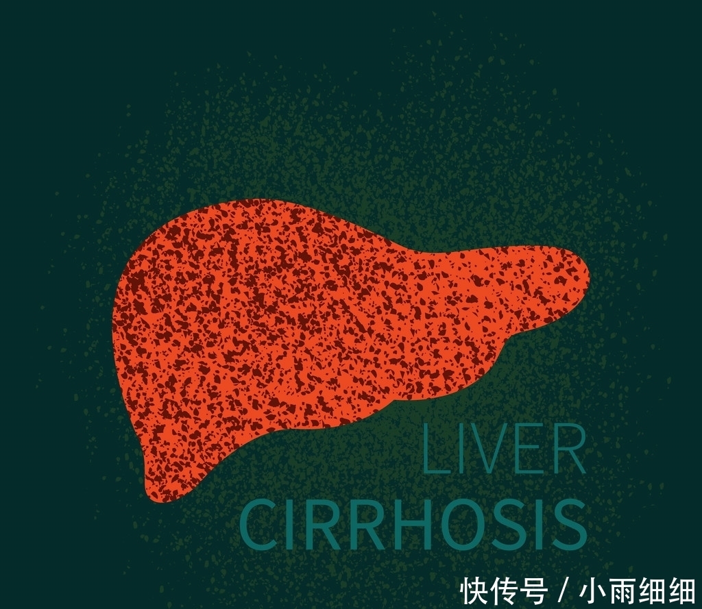 长期喝酒的人,三个检测能顺利通过,恭喜你暂时没有肝癌