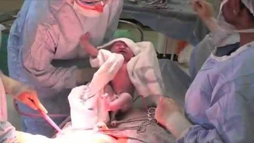 胎儿|剖腹产后最痛的一个护理环节!护士喜欢做,产妇见了就害怕