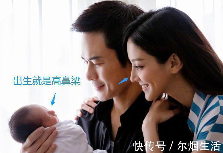 郑嘉颖|宝宝的鼻梁何时“定型”?塌鼻梁的娃想“逆袭”,要满足哪些条件