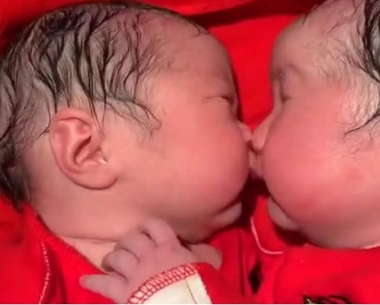 心灵感应|双胞胎姐妹出生20分钟后,姐姐对妹妹的行为,让护士泪目了