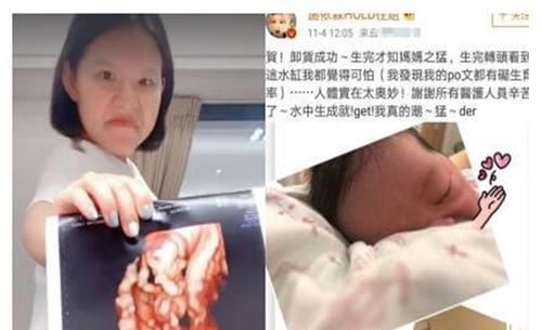 剖腹产|“水中分娩”为何成为现今首推?这些优势你想象不到,孕妈的福音