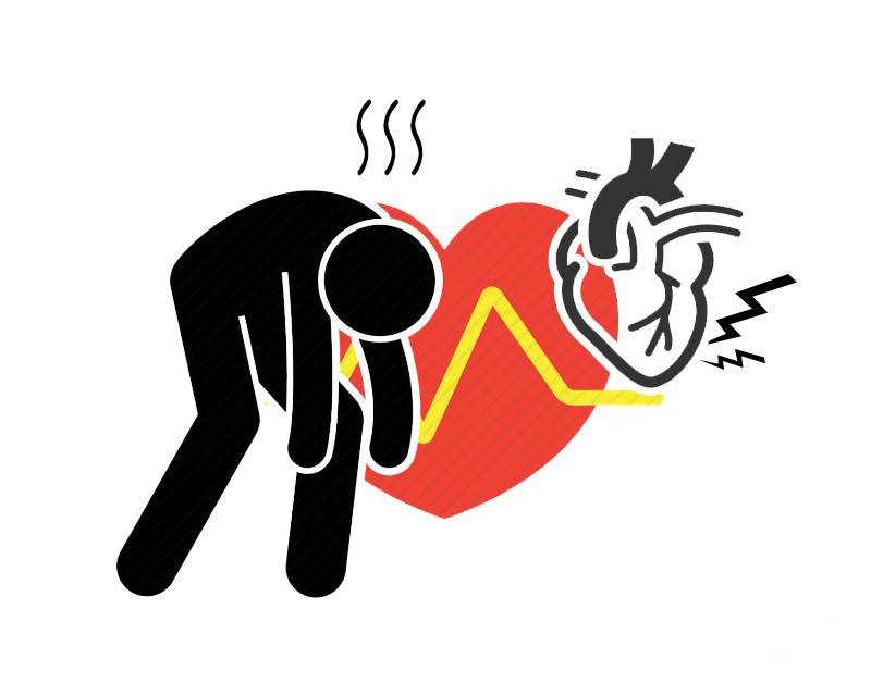 心绞痛|长期放纵释压,男子差点死在心梗?做好5件事,别给自己留下遗憾