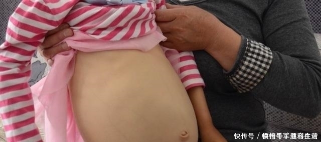 调理|6岁女娃,便秘2周不拉,儿科主任再拖,孩子就停止发育了