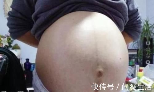 妈妈们|肚子长毛、有黑线？怀孕后肚子的这几点变化最明显