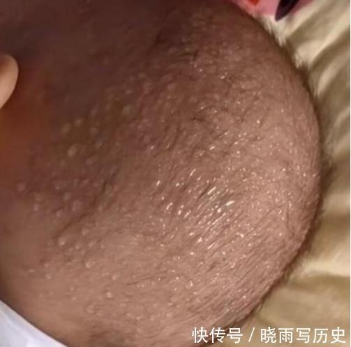 清湖小学|12岁女孩身高直冲165公分,医生:2种食物堪称“长高王”,可多吃