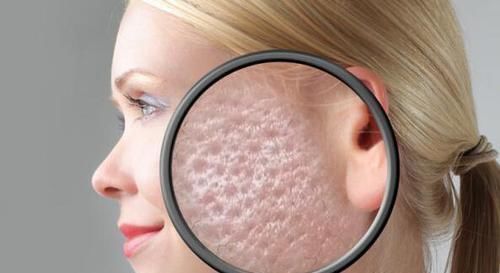 除螨|卧榻之下,岂容“他人”酣睡,小小螨虫,竟然能威胁你的生命