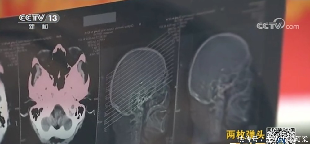 两枚弹头,一段跨越近70年的故事