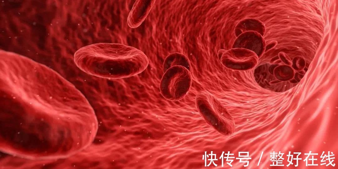 丹麦|瘦子不会得高血脂吗?别过于安逸,你可能已经中招,日常注意3点