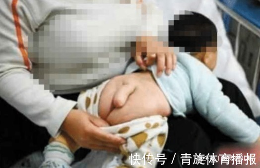 脊髓栓系综合征|半岁男宝竟长出了“小尾巴”,送医院检查后,医生怒骂宝妈太无知