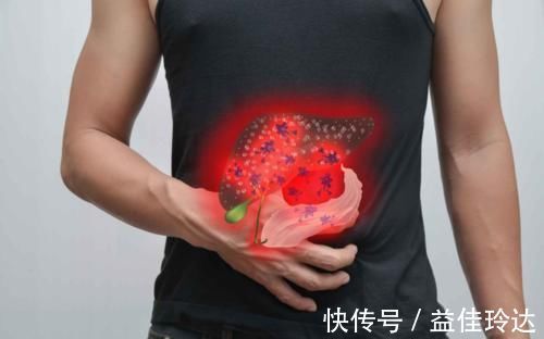 医生|多吃苦瓜能养肝？肝病医生说出答案：3物伤肝，平时常见不要碰