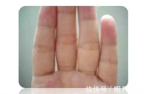 面色|补气血，一定要先要补这里，否则补再多也是白搭