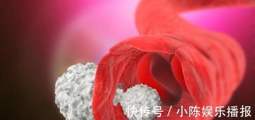 高血脂|甘油三酯偏高是高血脂医生坦言若没超过“这个数”,大可放心