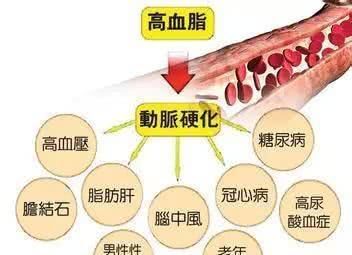 血脂高的人, 若每天吃这几样食物, 血脂或许会慢慢降下来!