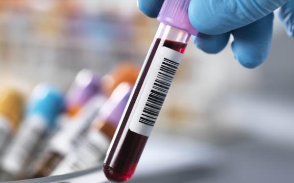 这些人|隔多长时间检查一次血脂比较好?医生:这些人5年查一次就够了