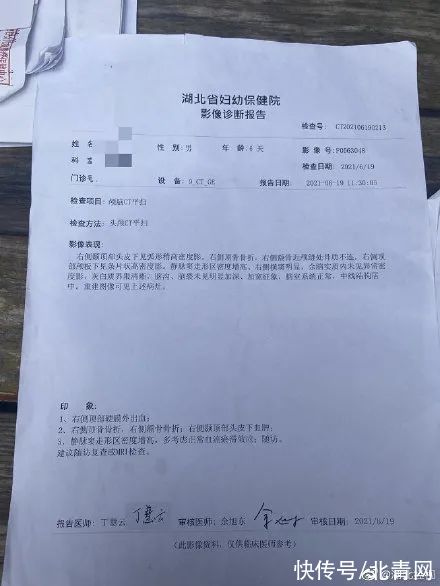 后遗症|因月嫂打瞌睡，出生6天宝宝被摔成颅骨骨折，宝妈：月嫂一天收费500元