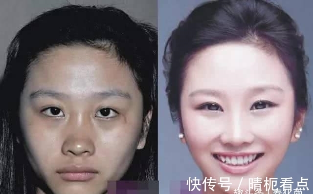 美白|实拍:10张女孩整容前后的对比照,这真就是换了一张脸