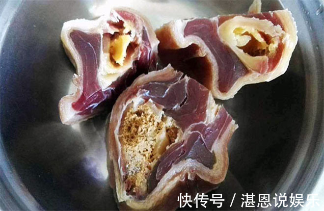 妇科炎症|妇科医生有炎症的女人,少吃“2肉”,做好1事,防霉菌,养子