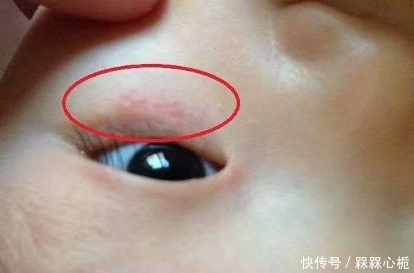 医院|女儿频繁揉眼睛,父母带去医院检查,惊出一身冷汗!网友真心大!