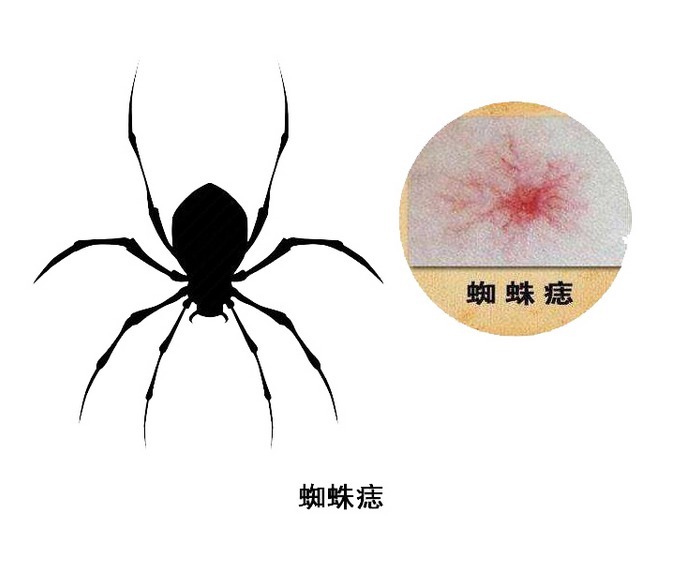 异常|别光顾着吸烟喝酒,身体出现4个异常,怕是肝要亮起“红灯”!