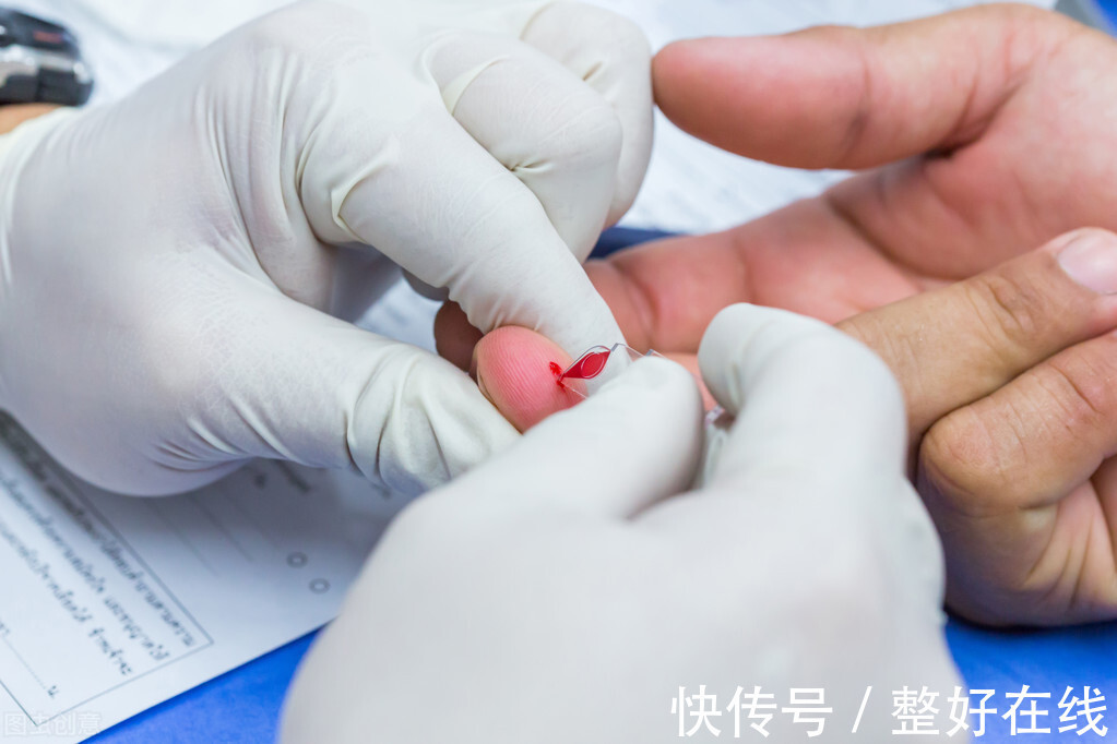 血糖浓度|糖尿病患者不经测试，怎样判断血糖高低？医生：可以注意以下几点