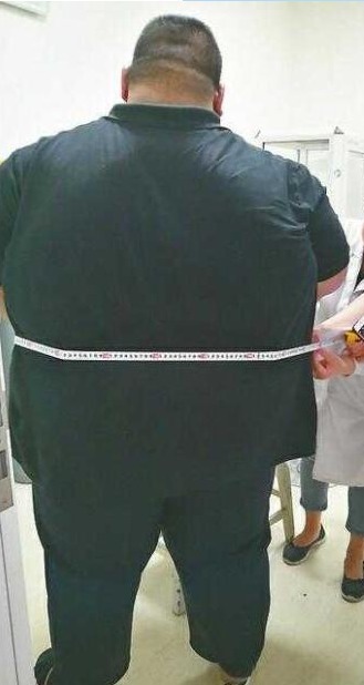 体能|他是中国第一胖子，重668斤，为爱减掉400斤，如今怎样了