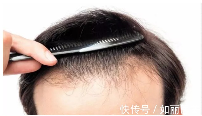 鉴定 “上午植发,下午上班”,地铁里的植发广告真的靠谱吗?