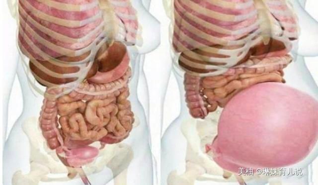 肚子|孕妈的肚子怎么可以那么大看看内脏被挤成啥样,女人当妈不容易