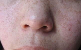 43岁家庭主妇坚持2招养肤，皮肤白嫩似“少女”，医生：值得借鉴