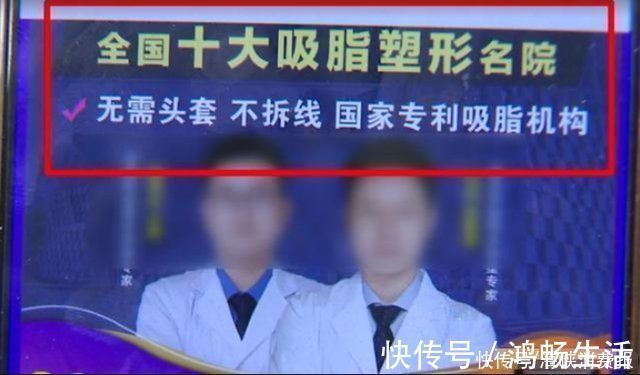 抽脂手术 小伙子为了求婚,做面部吸脂手术,结果反而更胖