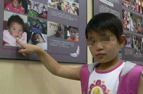 海中|妈妈故意弄丢6岁兔唇女儿,20年后在人海中相遇,如今悔不当初