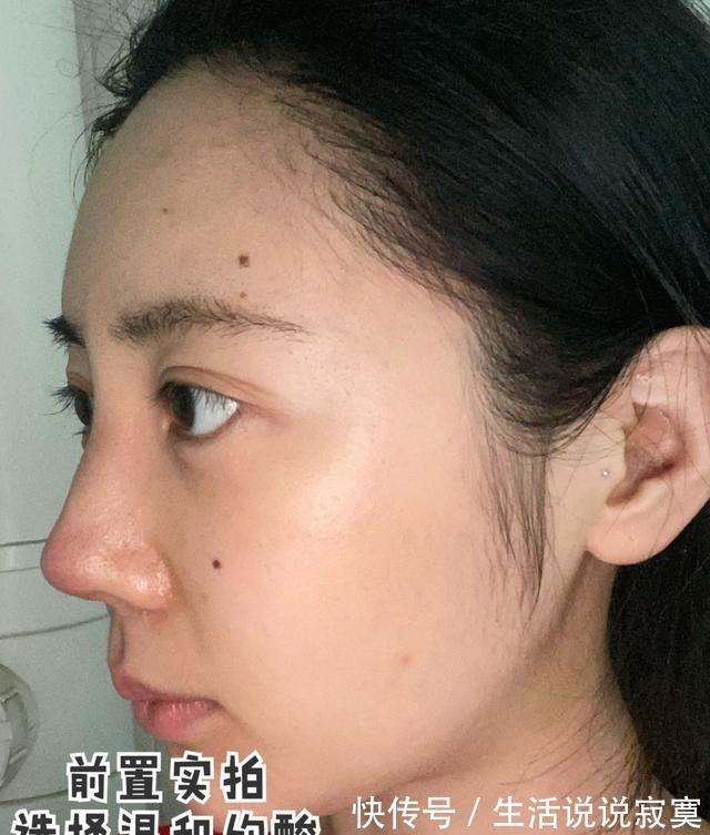 护肤品 果酸术后超全护理大全!