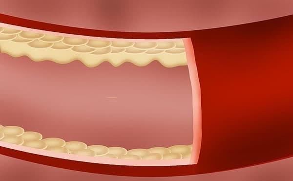 一天只要走多少步,就能护血管认准这个范围,坚持走就行