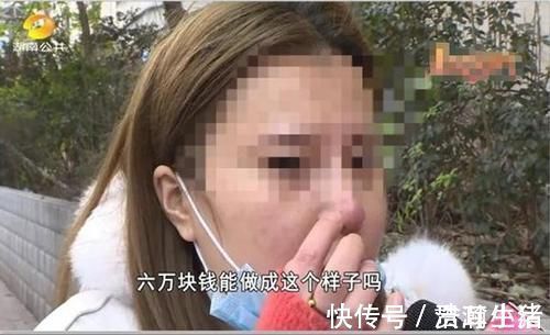 眼角膜|女子花60000整容，术后却整成“凹陷鼻”，找其理论主刀医生闭门不见