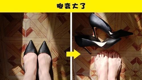 身体|女性在怀孕期间可能会出现的9个身体变化