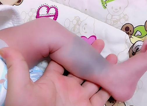 化妆品|孕期这三个行为,容易让胎记找上宝宝,准妈妈需尽量避开