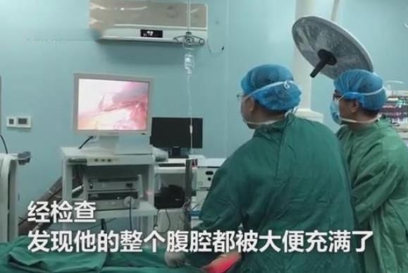 男子饭后肚子发生爆炸,医生从其腹腔吸出3000毫升粪水