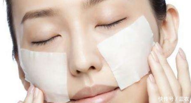 皮肤|鼻上黑头别傻傻再用手挤,皮肤科医生教你一招,让黑头自动流出来!
