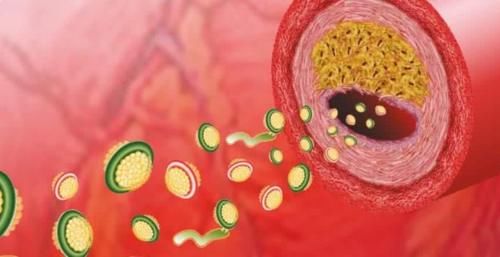 血脂|吃肉=血脂高?看看你就明白了!避开3习,和3物同吃,放心吃肉