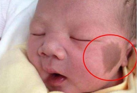 事孕妈|怀孕后三件事孕妈最好别做,容易在宝宝身上留下“胎记”!