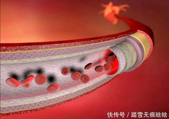 营养物质|脑供血不足时,身体可能出现一些变化,别不当回事,早知道早防范