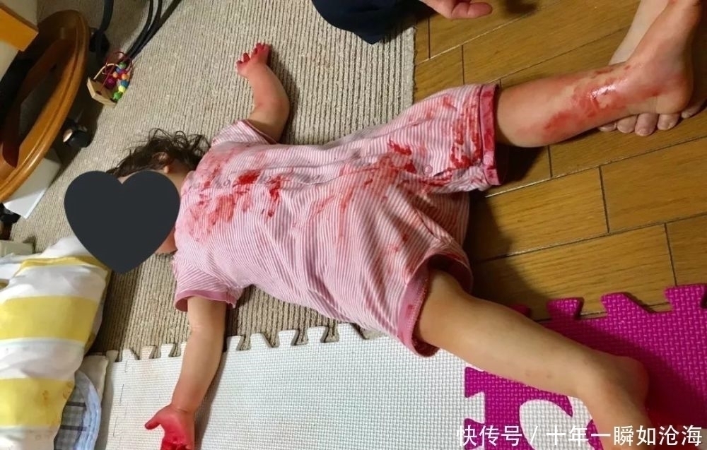小高|熊孩子用火龙果伪装自己,躺在“血泊”中,吓坏父母:差点完了