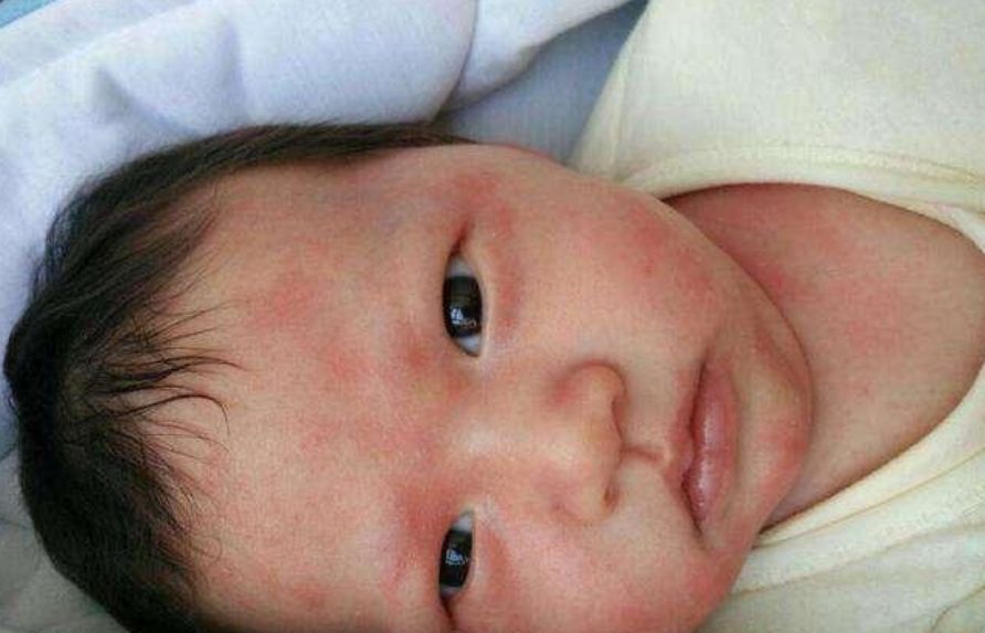 生长发育|孩子添加辅食,不要只盯着月龄看,这3个条件也很重要