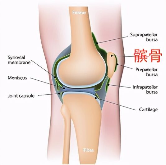 髌骨软骨软化症|步入中年，上下楼却膝盖疼？你可能得了“髌骨软化症”