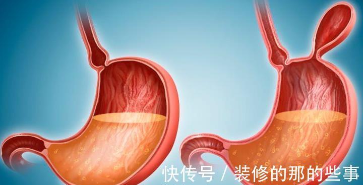 油炸食物|为何胃病患者越来越多?忠告:此类食物,即便再馋也不要去碰