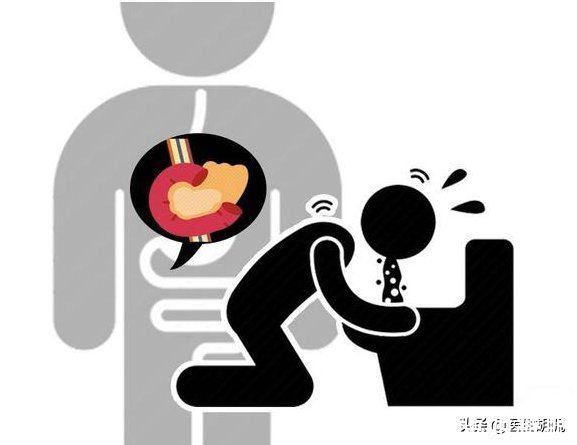 预防|胰腺癌被称“癌症之王”，做好4点可预防，若出现4个症状也需警惕